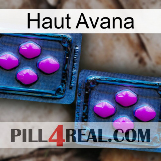 Top Avana 03